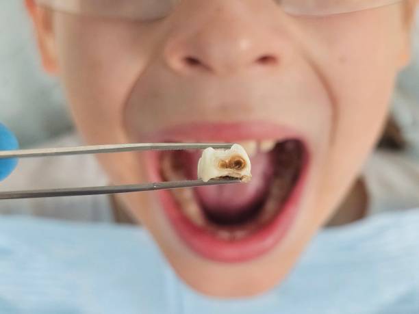 Best Walk-In Emergency Dental Services in New Baltimore, VA